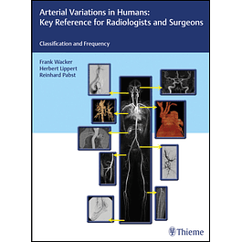 Arterial Variations in Humans: Key Reference for Radiologists and Surgeons: Classification and Frequency 