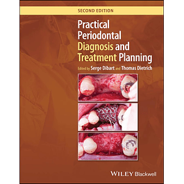 Practical Periodontal Diagnosis and Treatment Planning 