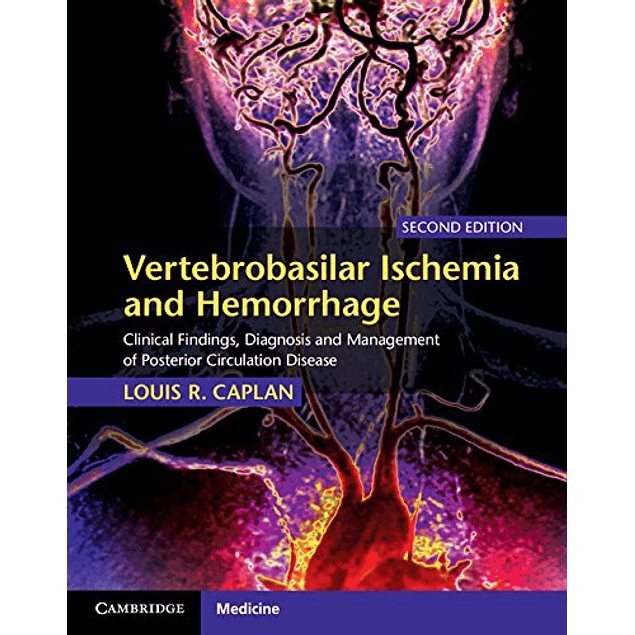 Vertebrobasilar Ischemia and Hemorrhage: Clinical Findings, Diagnosis and Management of Posterior Circulation Disease