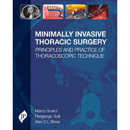 Minimally Invasive Thoracic Surgery: Principles and Practice of Thoracoscopic Technique