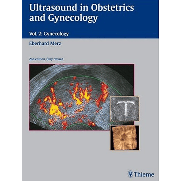 Ultrasound in Obstetrics And Gynecology: Volume 2: Gynecology 2nd Edition