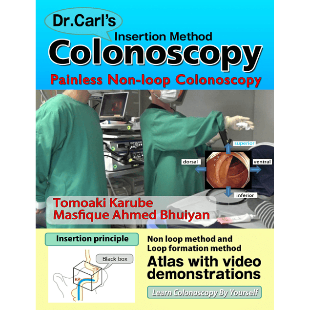 Dr. Carl's Colonoscopy insertion method: Painless Non-loop Colonoscopy