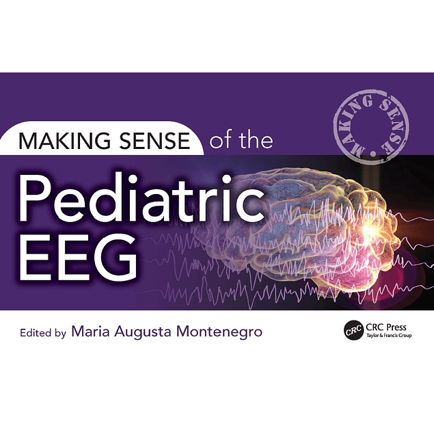 Making Sense of the Pediatric EEG