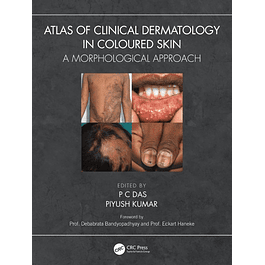 Atlas of Clinical Dermatology in Coloured Skin: A Morphological Approach