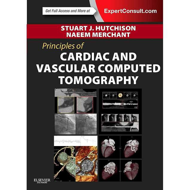 Principles of Cardiac and Vascular Computed Tomography 