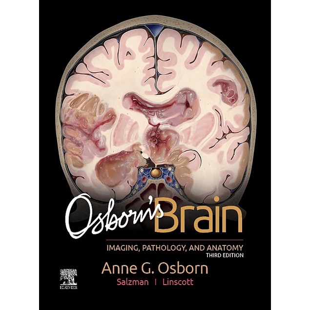 Osborn's Brain: Imaging, Pathology and Anatomy 3rd Edition