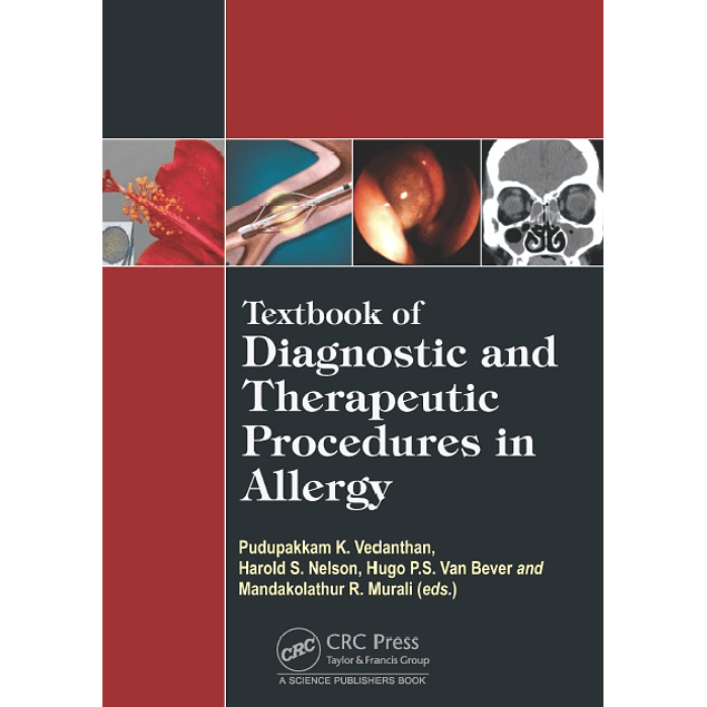 Textbook of Diagnostic and Therapeutic Procedures in Allergy