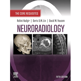 Neuroradiology: The Requisites: The Core Requisites
