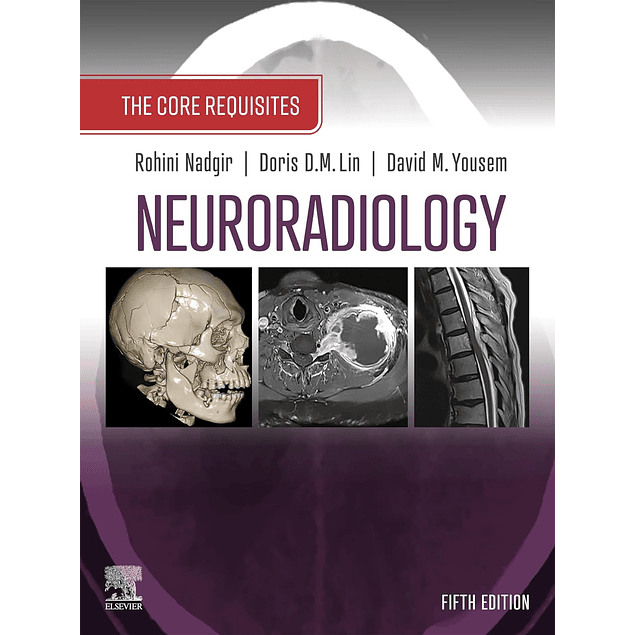 Neuroradiology: The Requisites: The Core Requisites