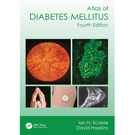 Atlas of Diabetes Mellitus 4th Edition