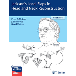 Jackson's Local Flaps in Head and Neck Reconstruction