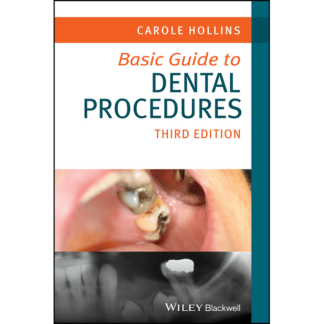  Basic Guide to Dental Procedures 3rd Edition 