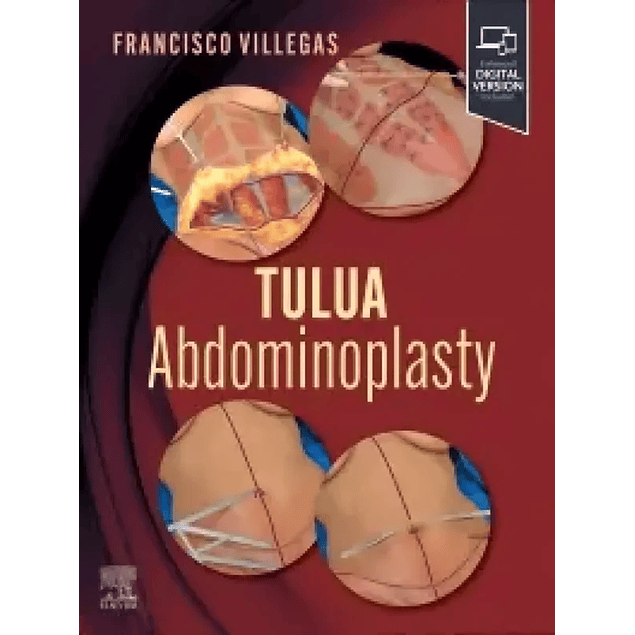 TULUA Abdominoplasty: Transverse Plication Technique