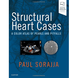  Structural Heart Cases: A Color Atlas of Pearls and Pitfalls 