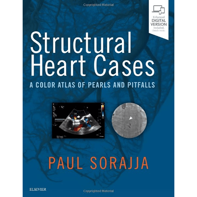  Structural Heart Cases: A Color Atlas of Pearls and Pitfalls 