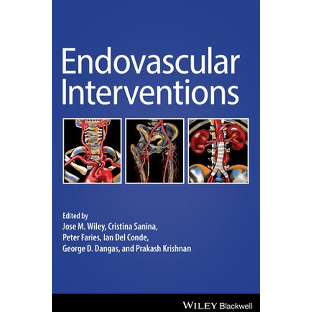  Endovascular Interventions