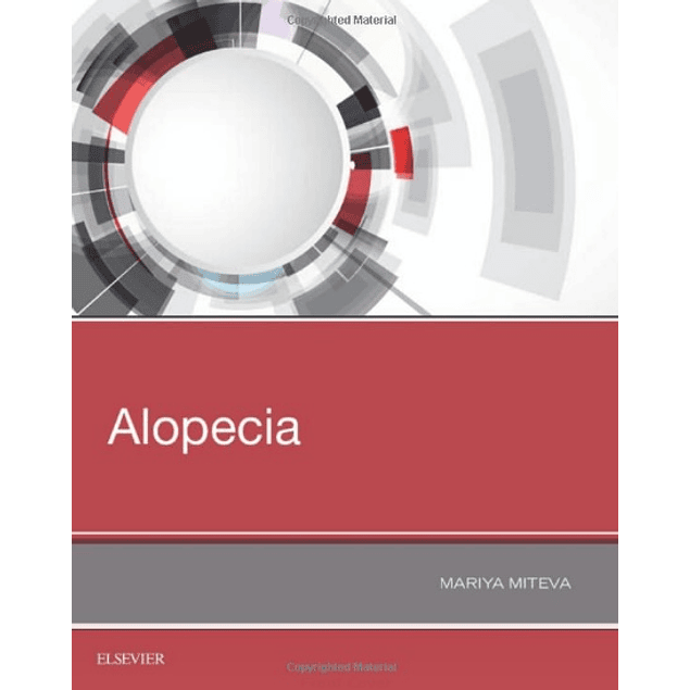  Alopecia