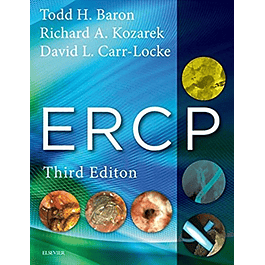 ERCP 