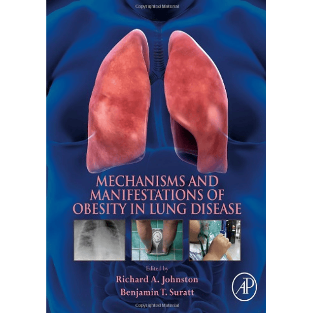  Mechanisms and Manifestations of Obesity in Lung Disease 