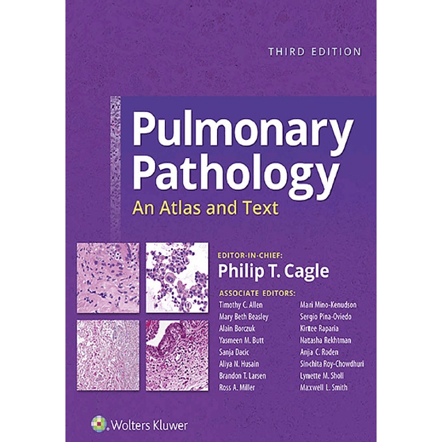  Pulmonary Pathology: An Atlas and Text 
