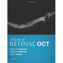  Atlas of Retinal OCT: Optical Coherence Tomography 