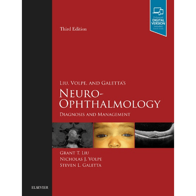  Liu, Volpe, and Galetta’s Neuro-Ophthalmology: Diagnosis and Management 