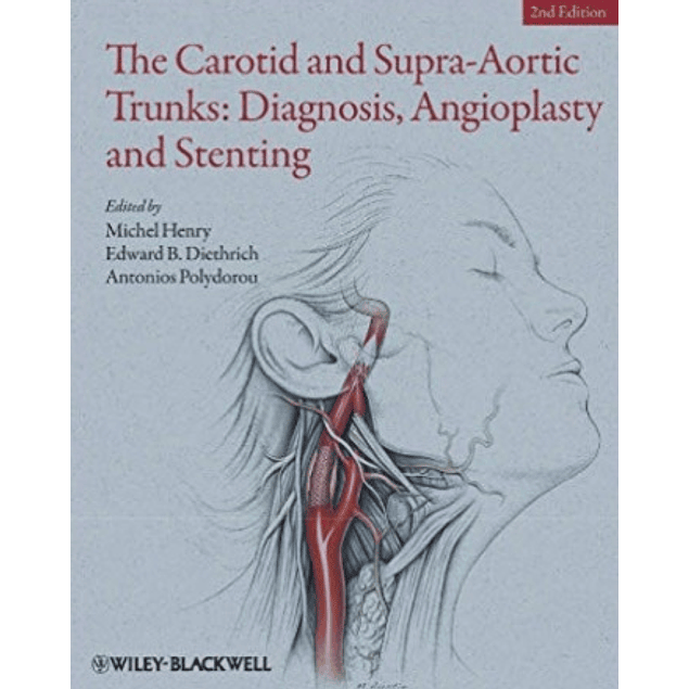 The Carotid and Supra-Aortic Trunks: Diagnosis, Angioplasty and Stenting