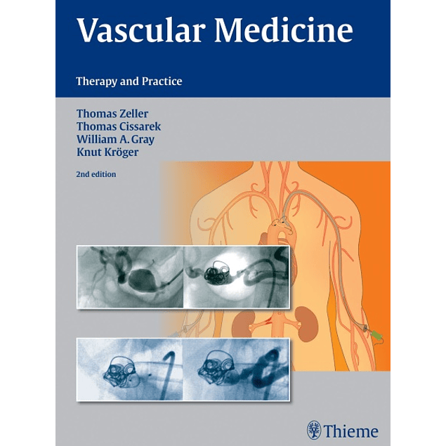 Vascular Medicine: Therapy and Practice 