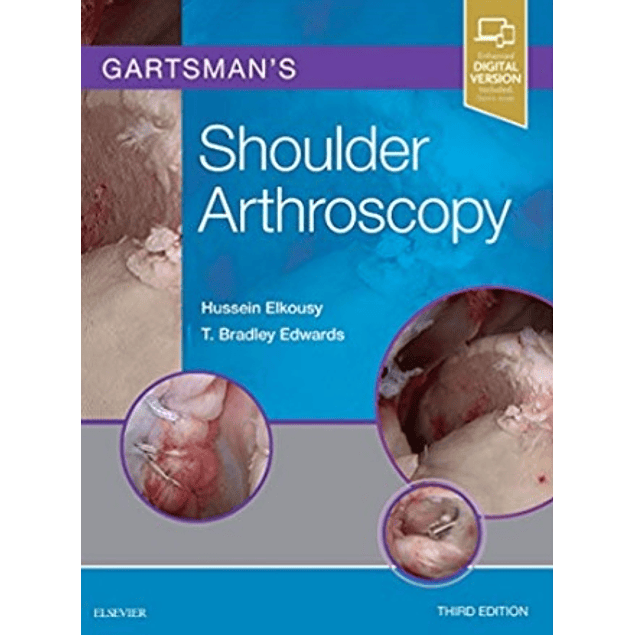 Gartsman's Shoulder Arthroscopy