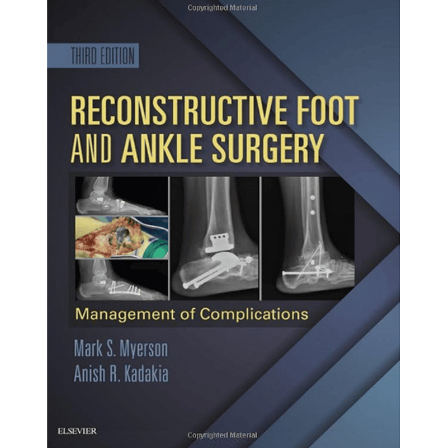 Reconstructive Foot and Ankle Surgery: Management of Complications