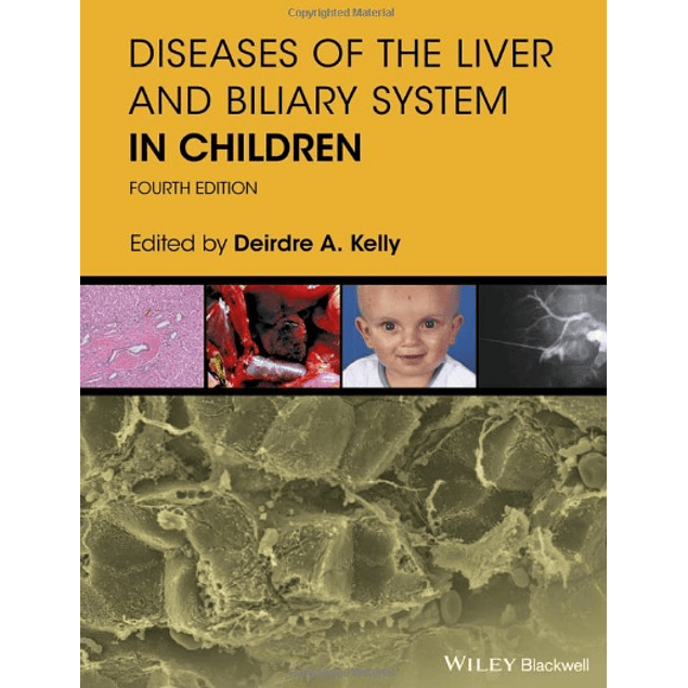  Diseases of the Liver and Biliary System in Children 