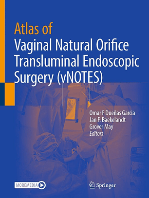 Atlas of Vaginal Natural Orifice Transluminal Endoscopic Surgery (vNOTES)