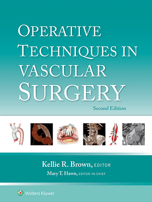 Operative Techniques in Vascular Surgery 2nd Edition