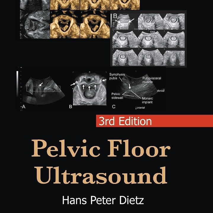 Pelvic Floor Ultrasound 3rd Edition 1