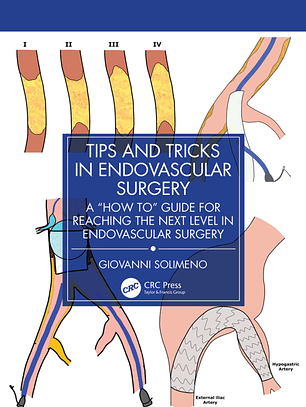 Tips and Tricks in Endovascular Surgery: A 
