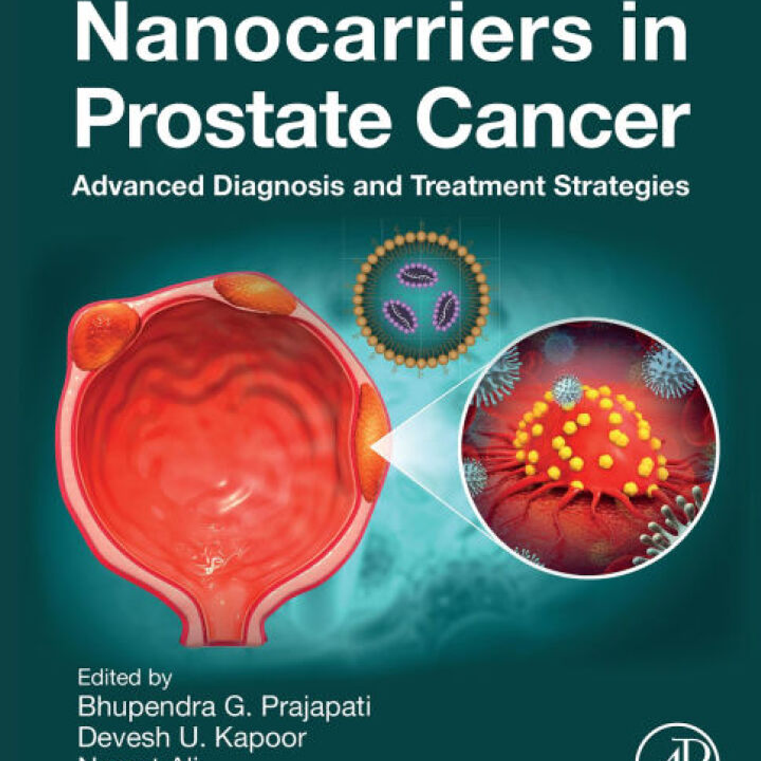 Nanocarriers in Prostate Cancer: Advanced Diagnosis and Treatment Strategie 1