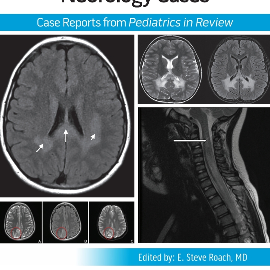 Pediatric Collections: Neurology Cases: Case Reports from Pediatrics in Review 1