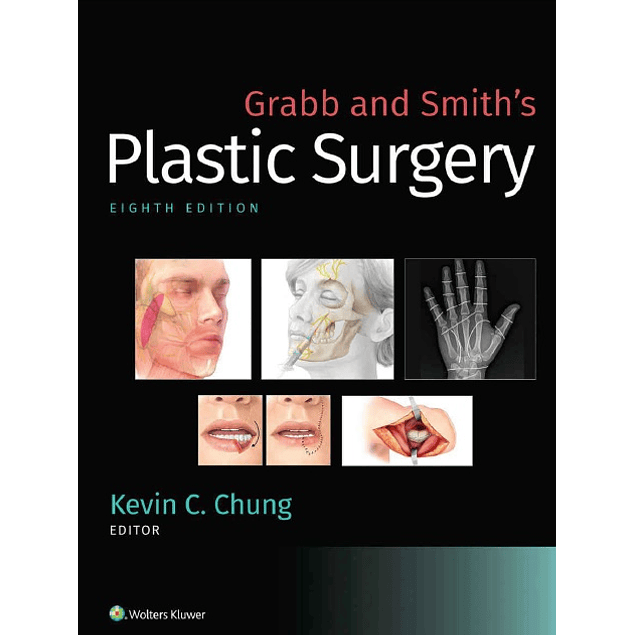 Grabb and Smith's Plastic Surgery