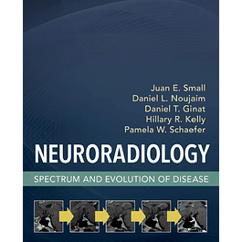 Neuroradiology: Spectrum and Evolution of Disease