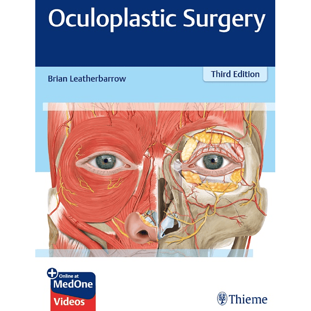 Oculoplastic Surgery