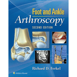 Foot & Ankle Arthroscopy