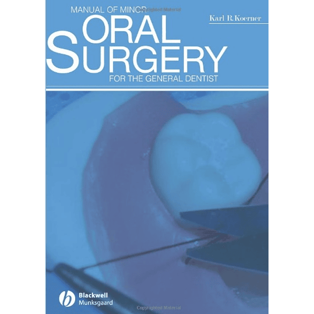 Manual of Minor Oral Surgery for the General Dentist