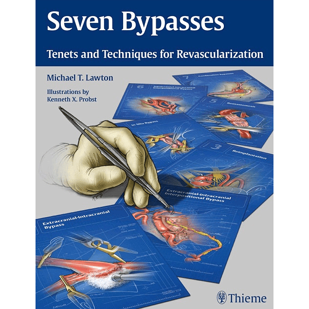Seven Bypasses: Tenets and Techniques for Revascularization