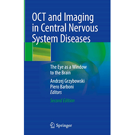 OCT and Imaging in Central Nervous System Diseases: The Eye as a Window to the Brain