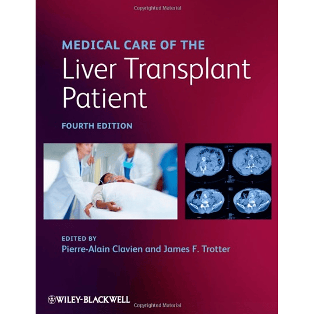  Medical Care of the Liver Transplant Patient 