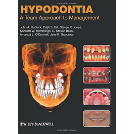 Hypodontia: A Team Approach to Management
