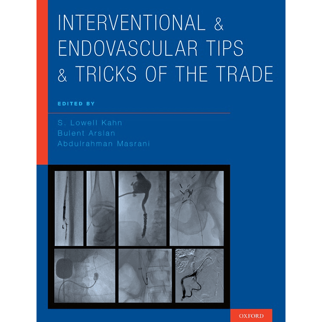 Interventional and Endovascular Tips and Tricks of the Trade