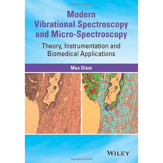Modern Vibrational Spectroscopy and Micro-Spectroscopy: Theory, Instrumentation and Biomedical Applications