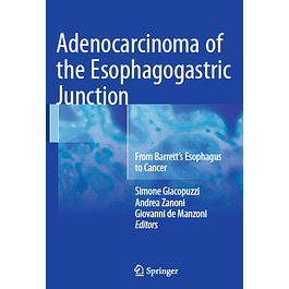 Adenocarcinoma of the Esophagogastric Junction: From Barrett's Esophagus to Cancer