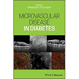  Microvascular Disease in Diabetes 